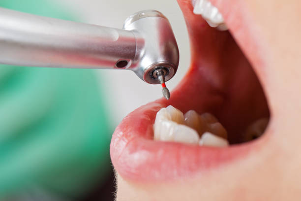 Best Weekend Emergency Dentist in Warrenvle, IL
